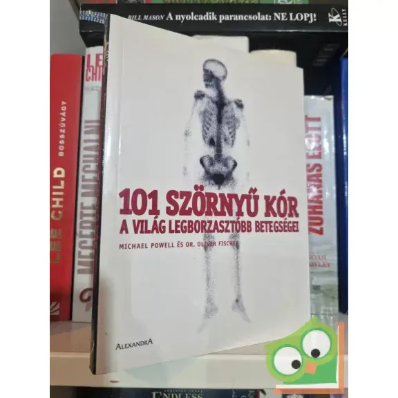 Michael Powell, Oliver Fischer: 101 szörnyű kór - A világ legborzasztóbb betegségei Exkluzív ajánlat