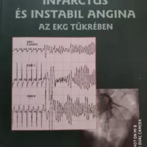 Outlet Tomcsányi János: Acut myocardialis infarctus és instabil angina az EKG tükrében