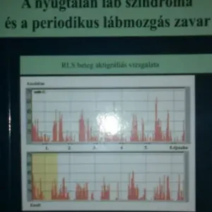 Köves Péter (szerk): A nyugtalan láb szindróma és a periodikus lábmozgás zavar (RLS beteg aktigráfiás vizsgálata) Ajánlat