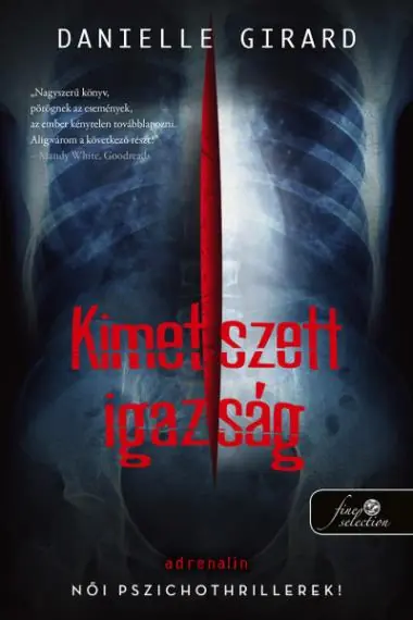 Csak ma Kimetszett igazság (Dr. Schwartzman 2.)